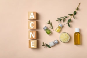 Natural Treatments for Acne